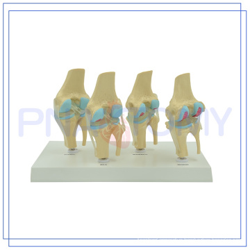 PNT-0141 life size Knee joints synthesis model